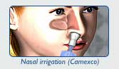 Nasal irrragation