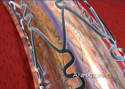 Animation MD, 3d Medical Animations